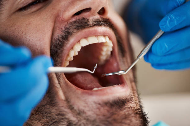 Best Emergency Cosmetic Dentistry (e.g., broken veneers) in Ferrysburg, MI